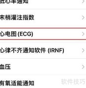 Apple Watch查看心电图教程