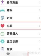 Apple Watch 7查看心电图教程