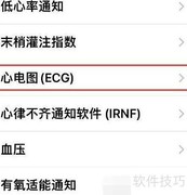 Apple Watch 7查看心电图教程