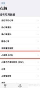 苹果手机如何测心电图
