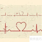 心电图T波改变解析