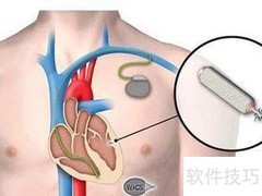 心脏康复适用人群与内容