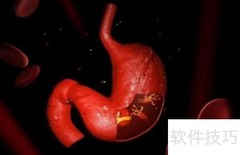 胃病易与哪些疾病混淆