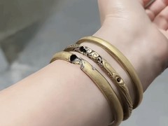 宿州女子充电时触电手部烧伤 金手镯碎裂疑因设备漏电