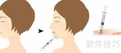 丰下巴的5种有效方法