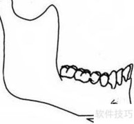 丰下巴的5种有效方法