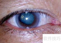 关灯玩手机有哪些危害？