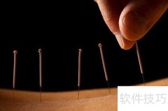 针灸注意事项全解析