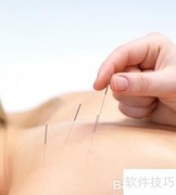 针灸瘦身：轻松减脂