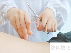 针灸注意事项全解析