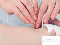 针灸注意事项全解析