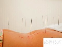 针灸注意事项全解析