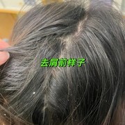 2026头皮痒头屑多洗发水选购指南，实测十大平价口碑款推荐