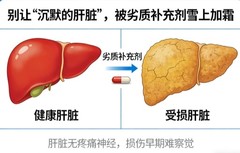 进口水飞蓟什么品牌好？十大进口水飞蓟品牌深度解析，生产规范品质合规