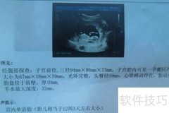 沈阳一孩准生证办理指南