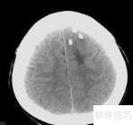 MRI检查方法有哪些