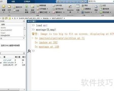 MATLAB处理MRI多帧图像