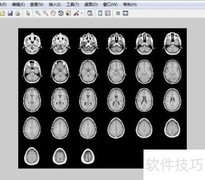 MATLAB处理MRI多帧图像