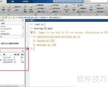 MATLAB处理MRI多帧图像