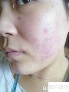 瑞美莱使用指南