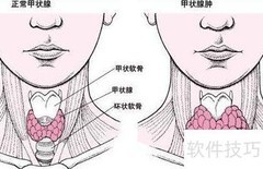 GD在医学中的含义解析