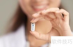 胶囊胃镜的五大优势