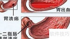 胃镜检查全过程揭秘