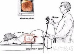 照肠镜前注意事项须知