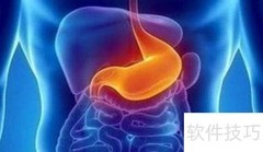 胶囊胃镜滞留及禁忌人群