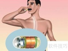 普通与无痛胃镜有何不同