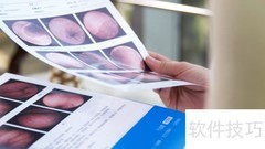 磁控胶囊胃镜报告多久出