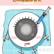 白内障超声乳化手术详解