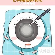 白内障超声乳化手术详解
