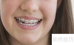 哈雷与透明保持器对比