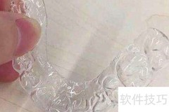 保持器佩戴步骤图解
