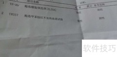 trust阴性是什么意思