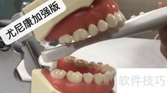 口腔内窥镜使用指南
