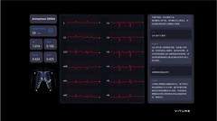 VITURE携手智源研究院发布全新XR AI 数字医疗应用