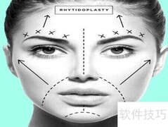 整容须知：术前术后全攻略