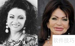 女友想整容，我该怎么办？