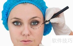 整容失败？原因竟在这