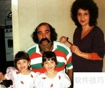 双胞胎整容前后大对比