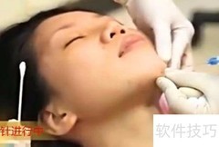 整容真的伤身吗？