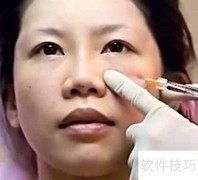 整容真的伤身吗？