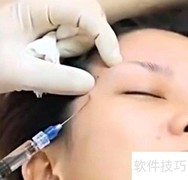 整容真的伤身吗？