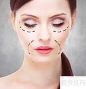 整容后遗症，你了解多少？