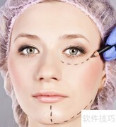 整容后遗症，你了解多少？