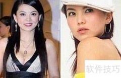 瘦脸针价格及反弹问题解析