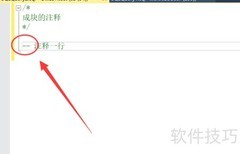SQL Server注释写法详解