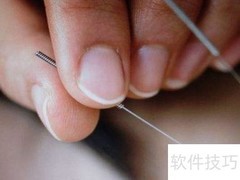 针灸缓解前列腺炎